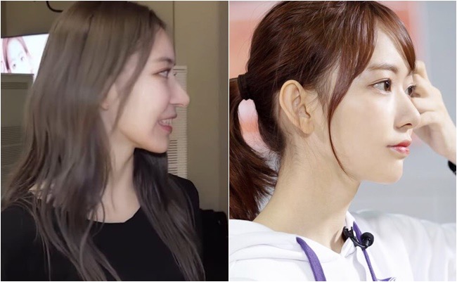 LE SSERAFIMのサクラは本当に整形してるのか？HKTデビュー当時からの画像を調べてみた