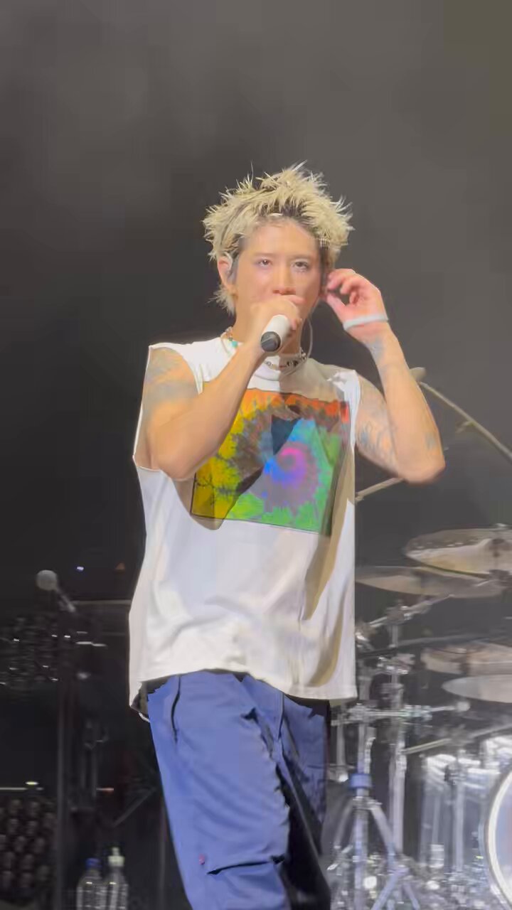 ONE OK ROCK(ワンオク)のTAKAが骨折の経過報告、レントゲン写真を公開。