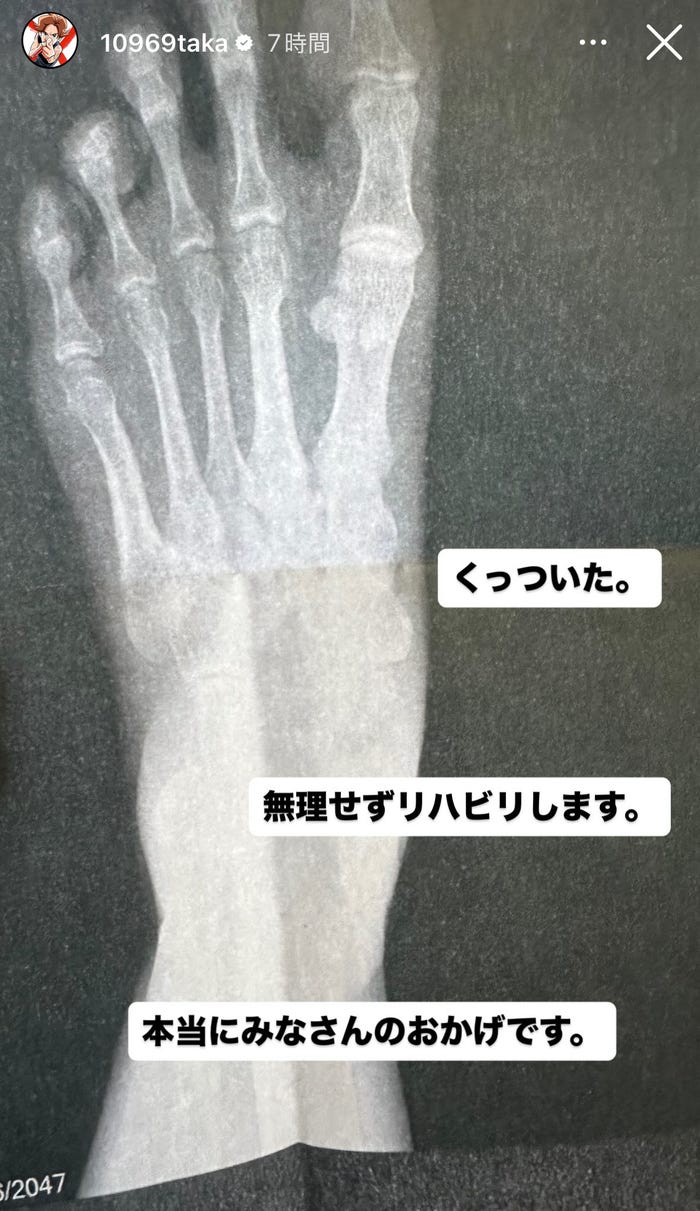 ONE OK ROCK(ワンオク)のTAKAが骨折の経過報告、レントゲン写真を公開。