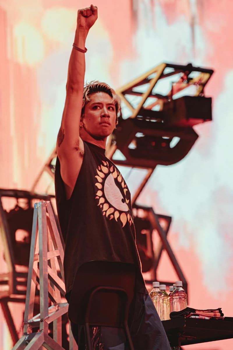 ONE OK ROCK(ワンオク)のTAKAが骨折の経過報告、レントゲン写真を公開。